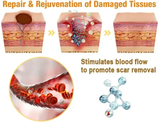 flysmus™ Lidocaine Scar-Free Pain Relief Healing Liquid