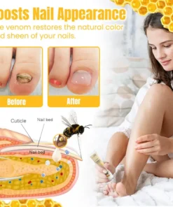 Ceoerty™ FungiGone Bee Venom Nail Cream