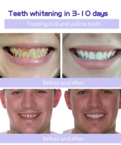 Cvreoz® Teeth Restoration Mineral Powder