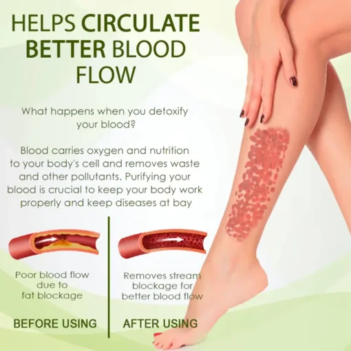 Fivfivgo™ SwellSoothe Lymphatic Cream