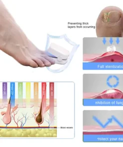 QIAWI™ Revolutionary High-Efficiency Light Therapy Device For Toenail Diseases