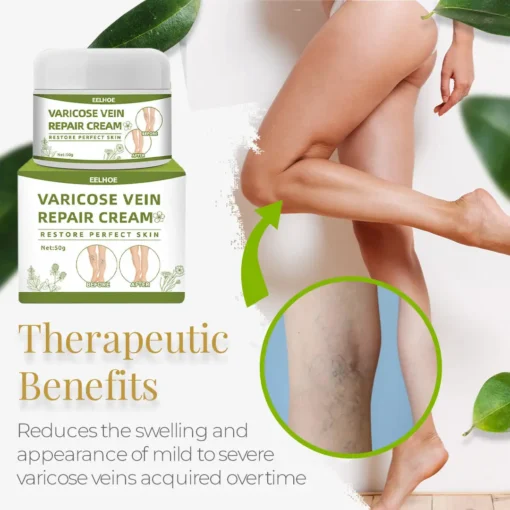 Varicose™ Vein Repair Cream (Point AAD Recommended) for Varicose Vein Removal, Spider Veins