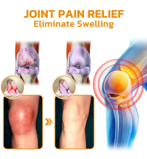 flysmus™ Lidocaine Arthritis Pain Relief Healing Gel