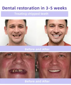 Oyikey® Tooth Restoration Mineral Powder