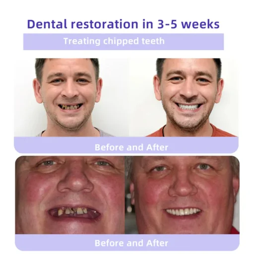 Oyikey® Tooth Restoration Mineral Powder