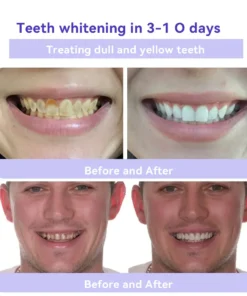 Oyikey® Tooth Restoration Mineral Powder