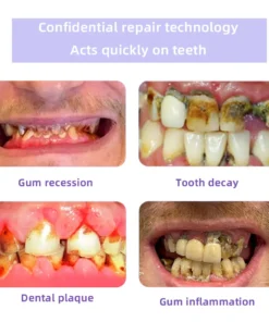 Oyikey® Tooth Restoration Mineral Powder