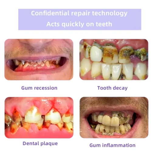 Oyikey® Tooth Restoration Mineral Powder